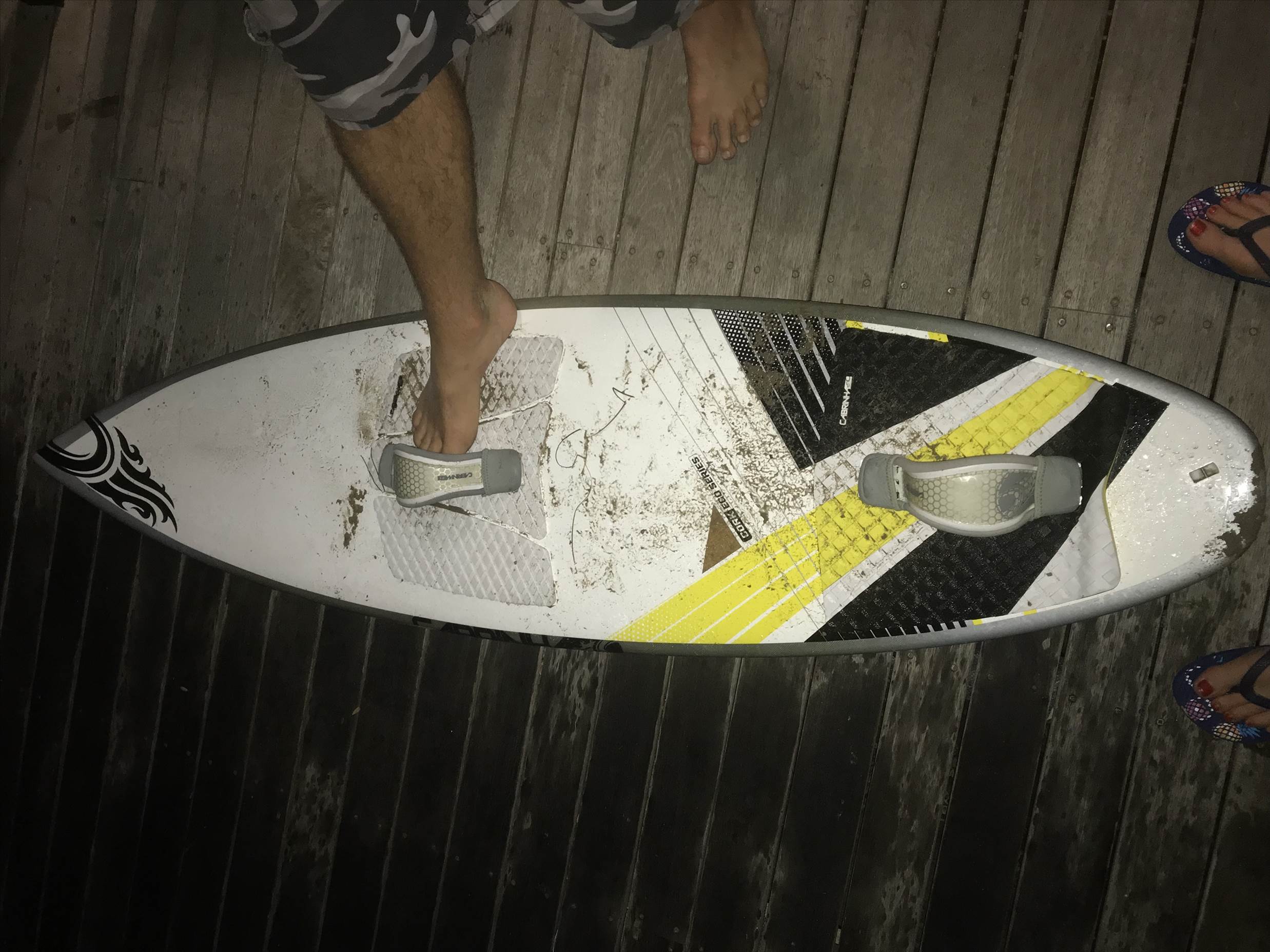 Are these straps facing the right way?