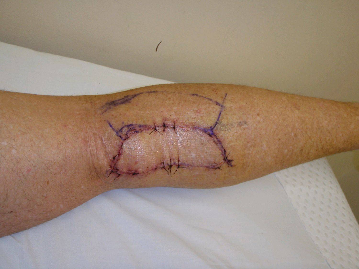 A shark bite would have been less life threatening