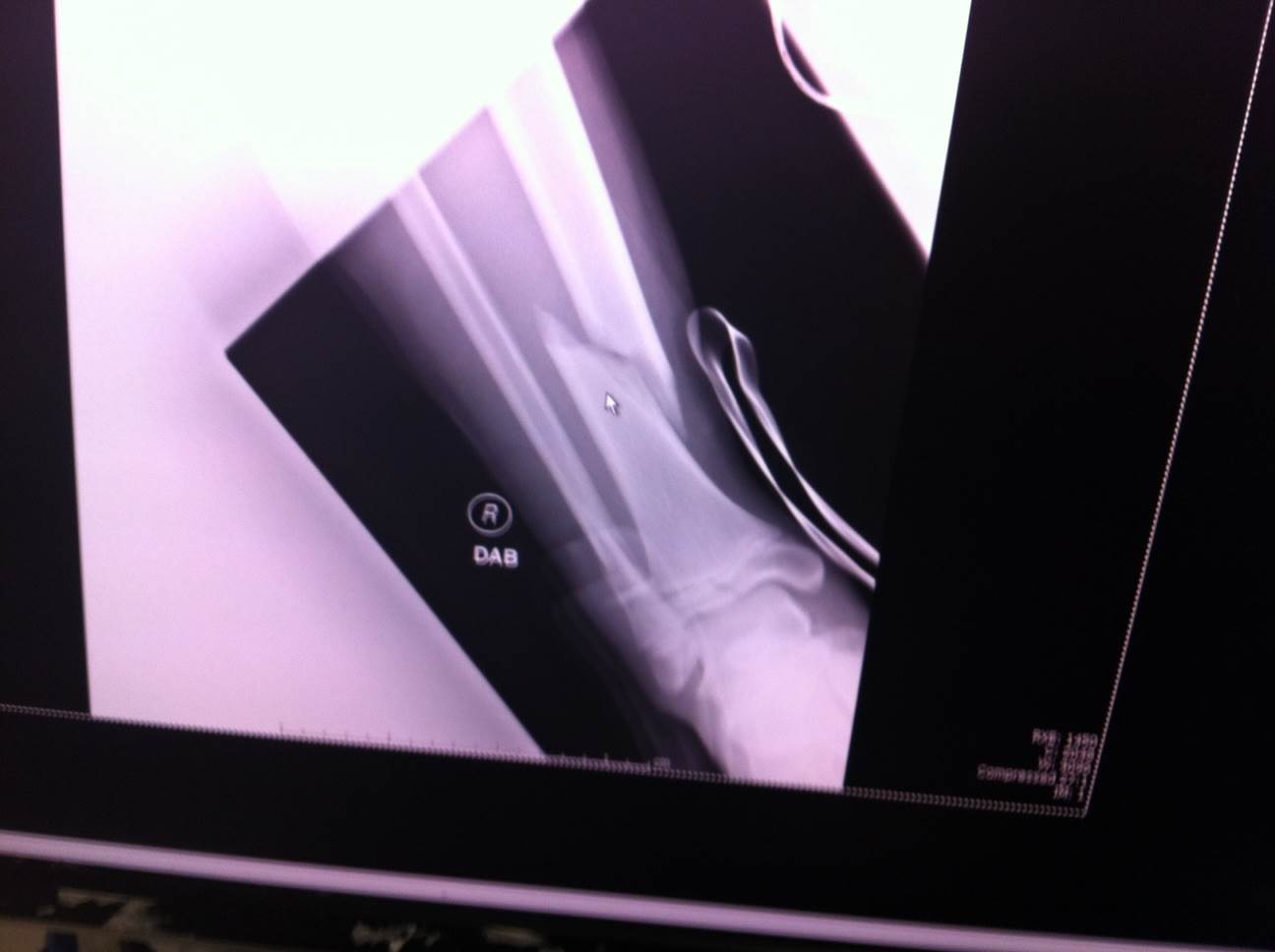 photo 1.JPG leg