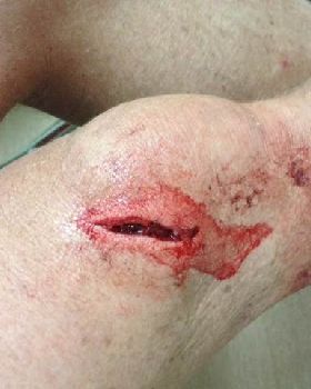ouch