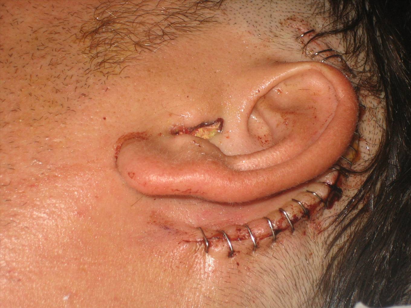 My ear