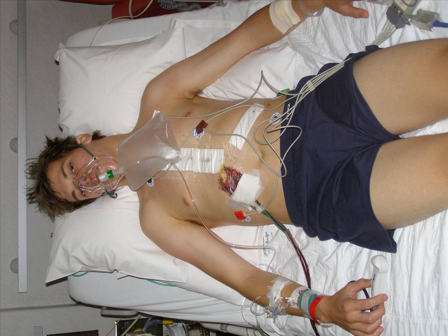 My trip to Melbourne for surgery