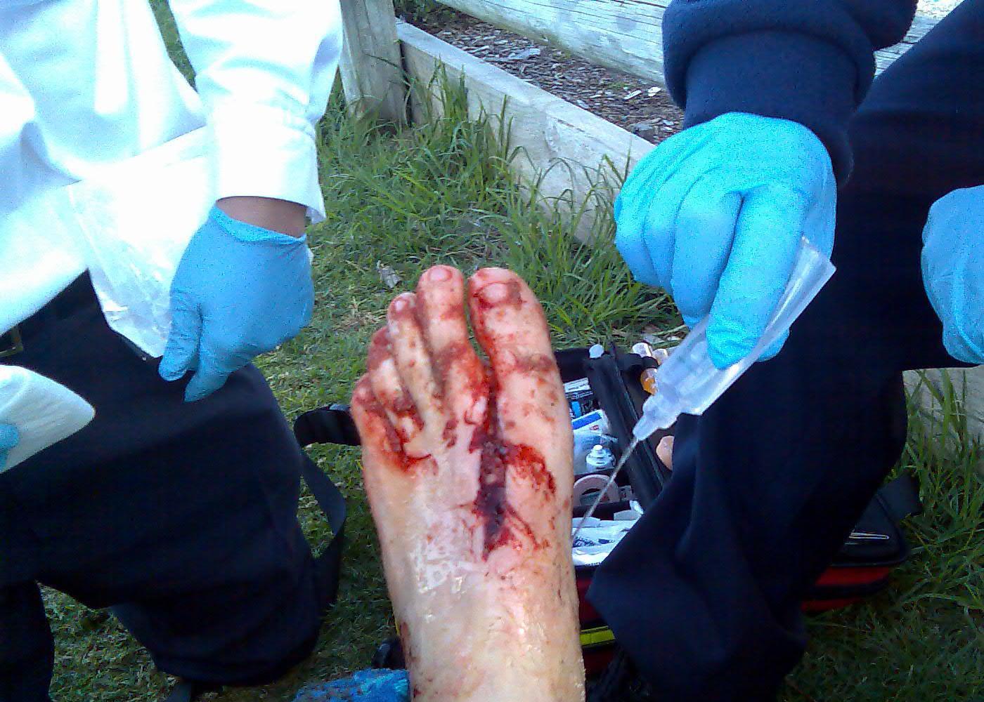 Board Bite