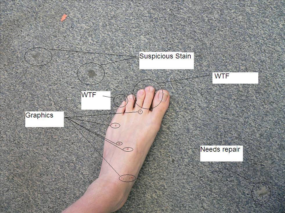 Foot1