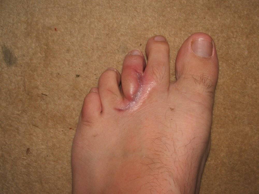 Foot sealant