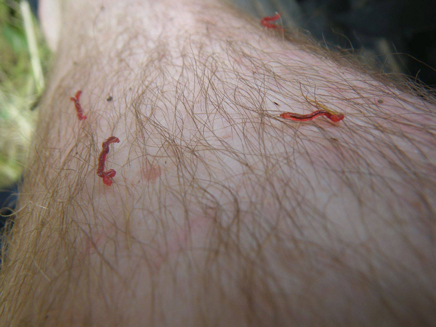 red worms crawling out of my skin