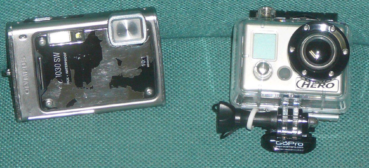 front on profile