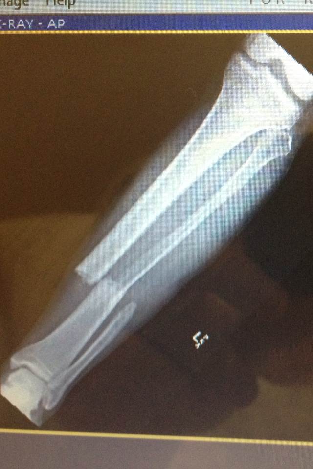 ouch..