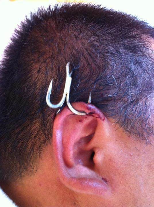 hook 2