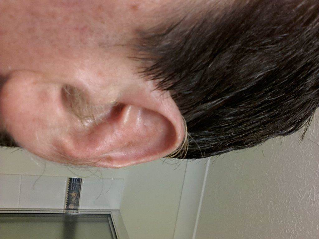 ear hair
