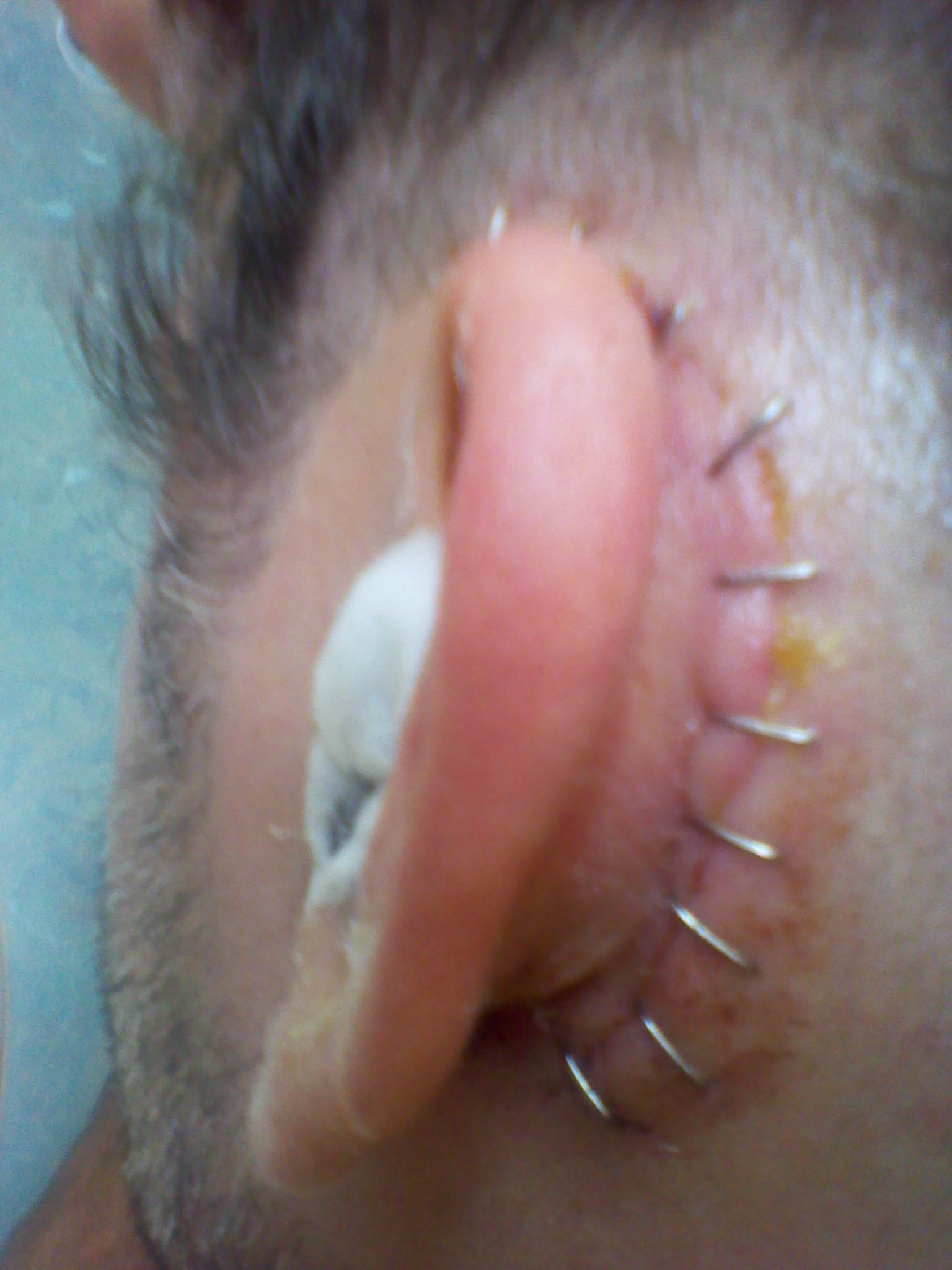 OUCH !!!!!!!!!