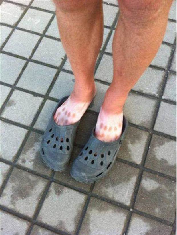 crocs