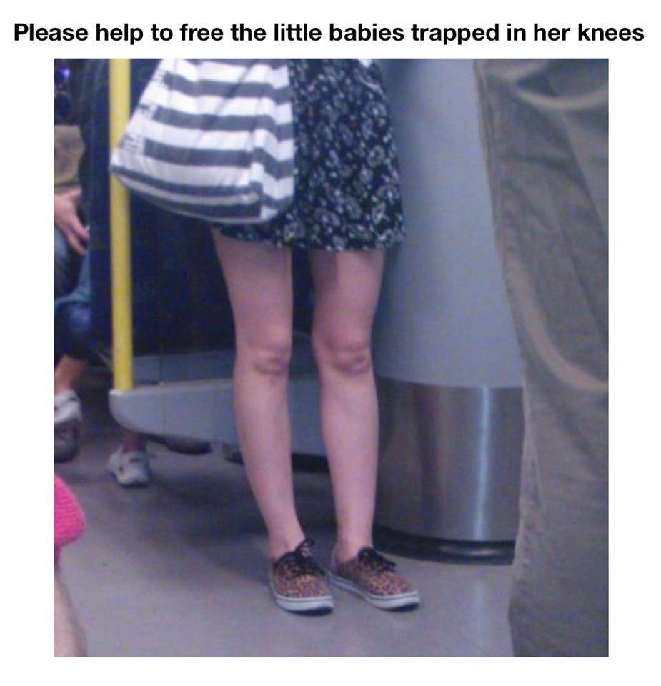 baBY KNEES