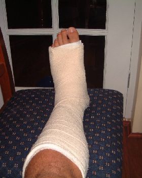 My ankle