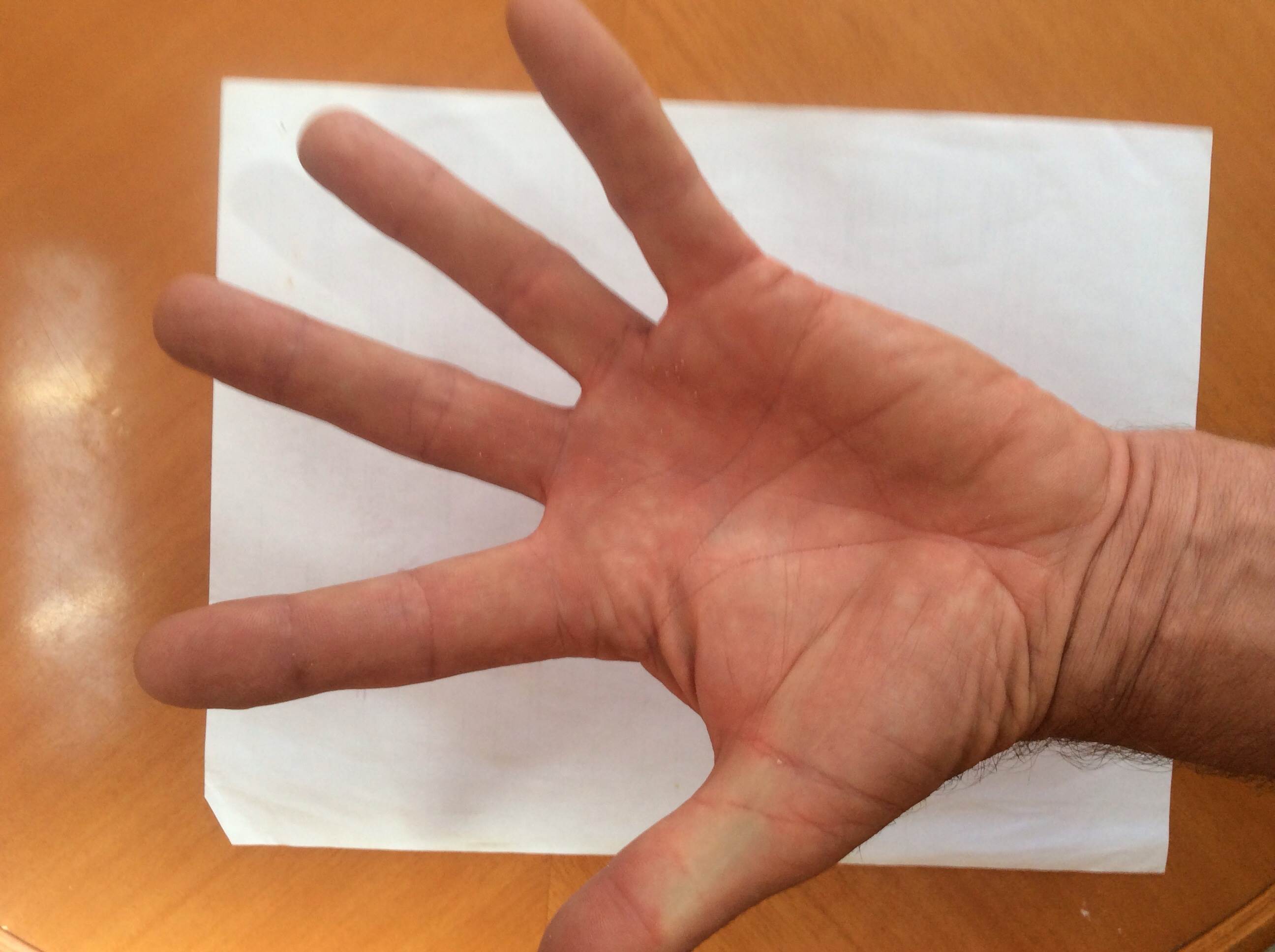 Hands
