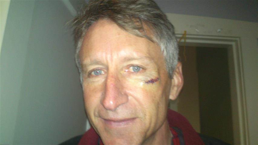 Ouch2