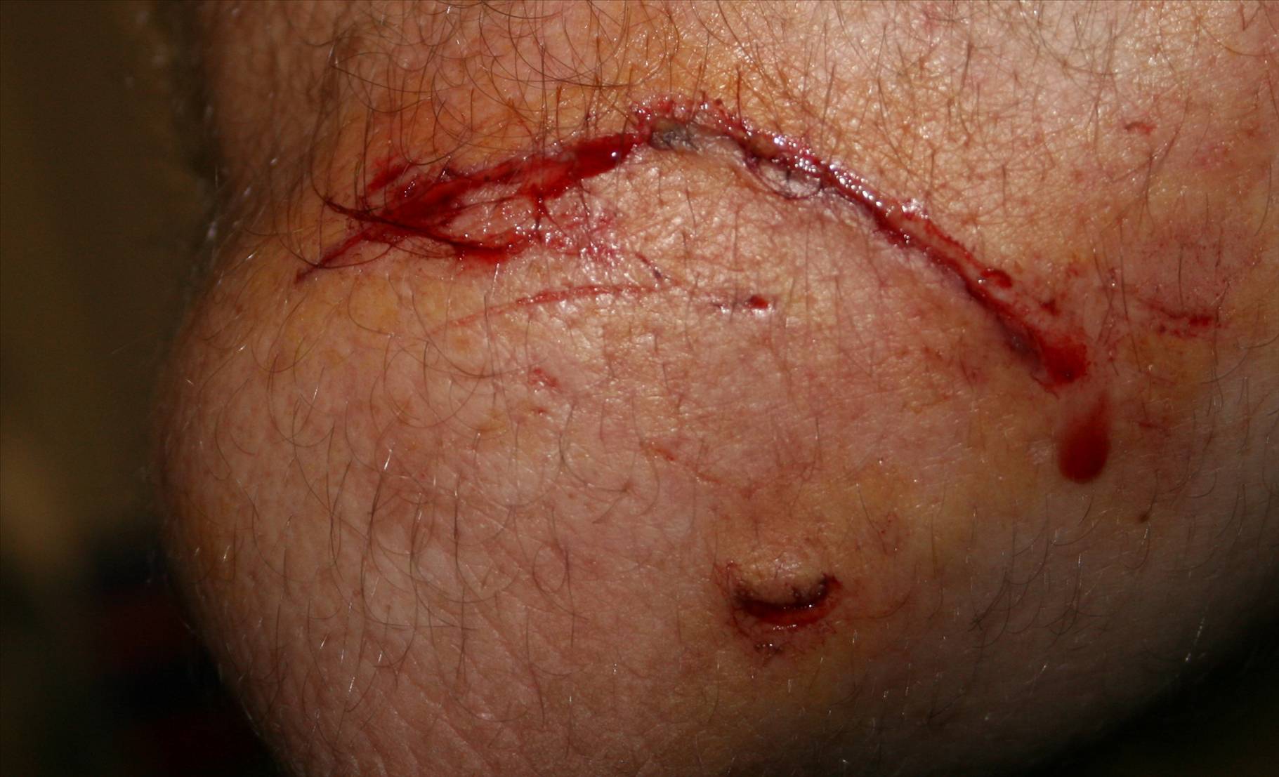 Elbow Slice
