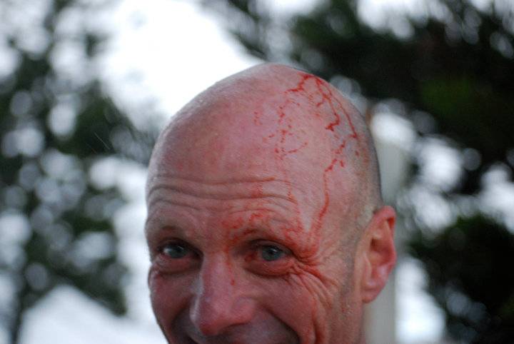 Al Bradley Hail Damage