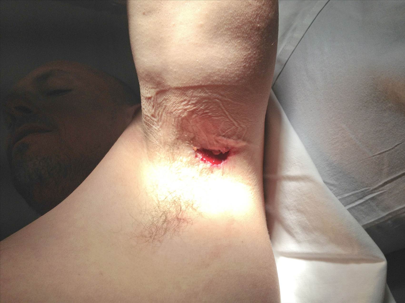 gash 1