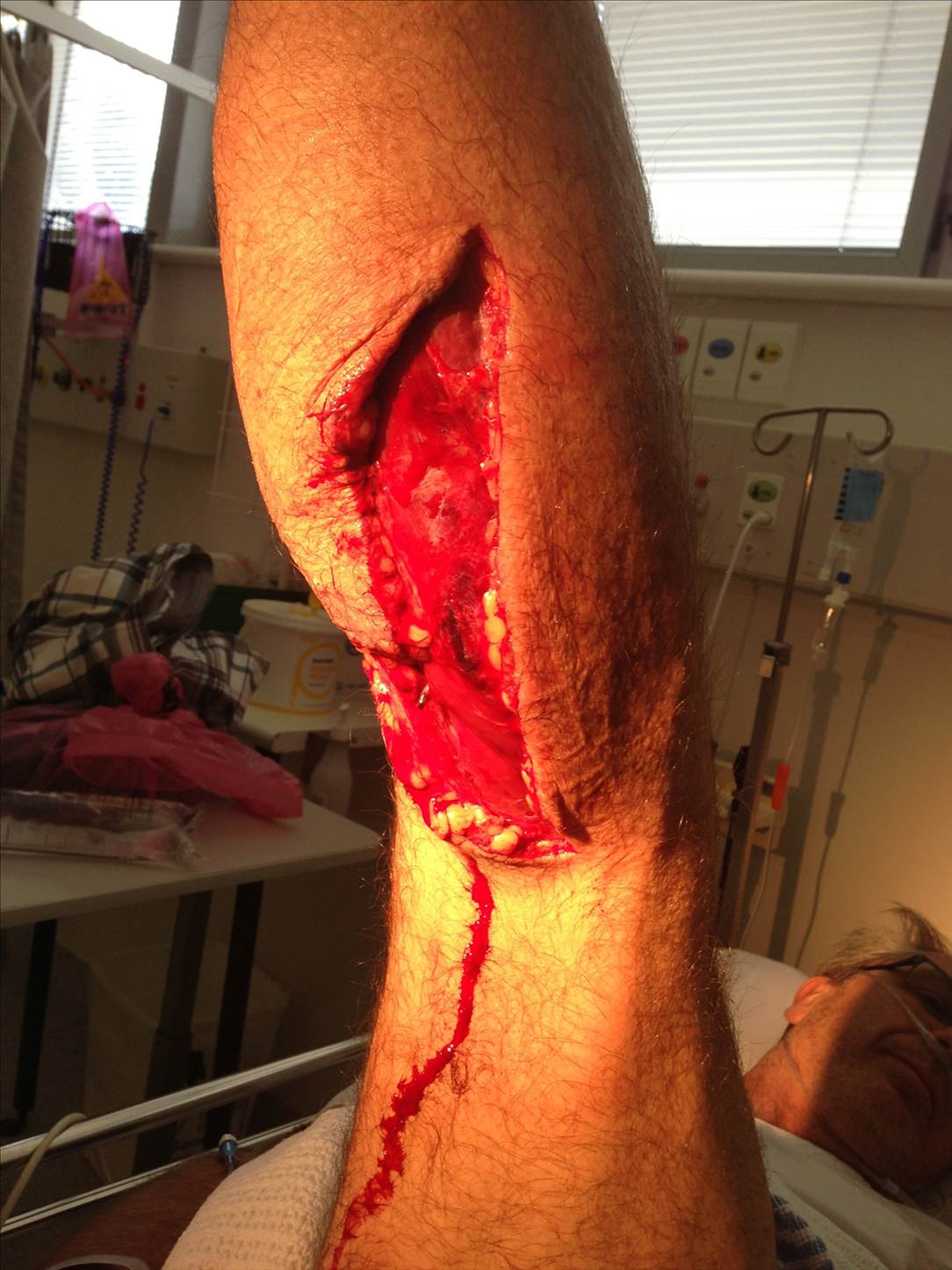 Gash if the week