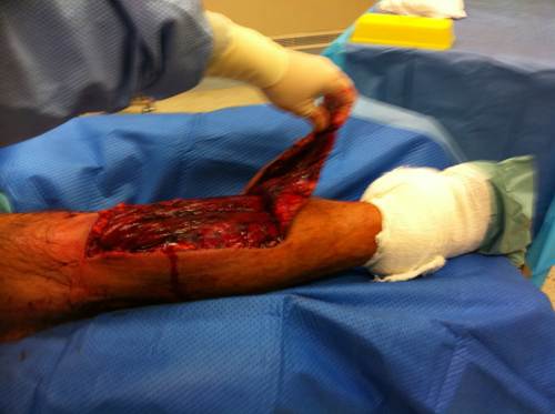 Leg before stitching small