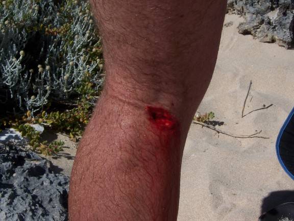 gash1