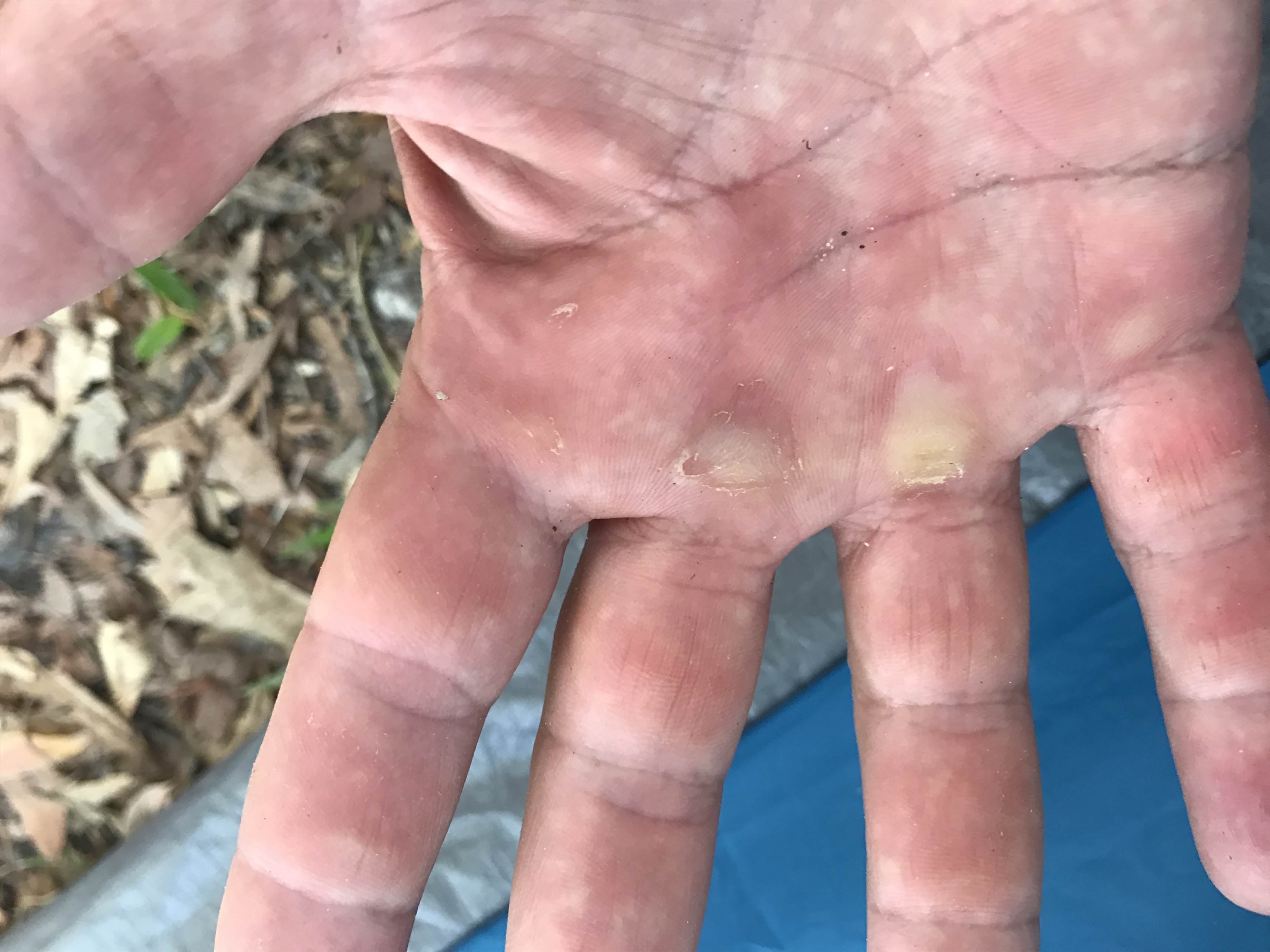 hand1