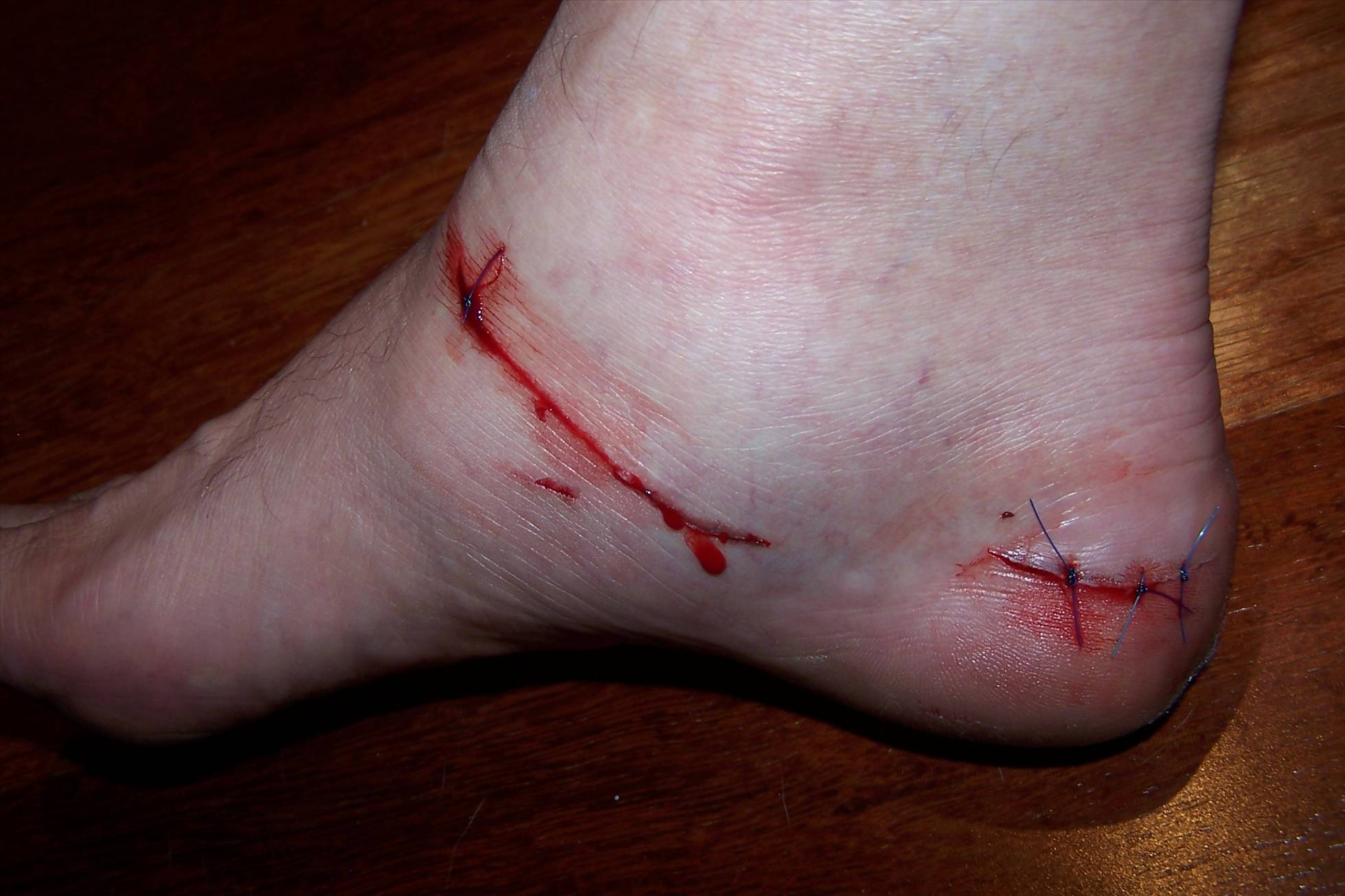 Fin Damage