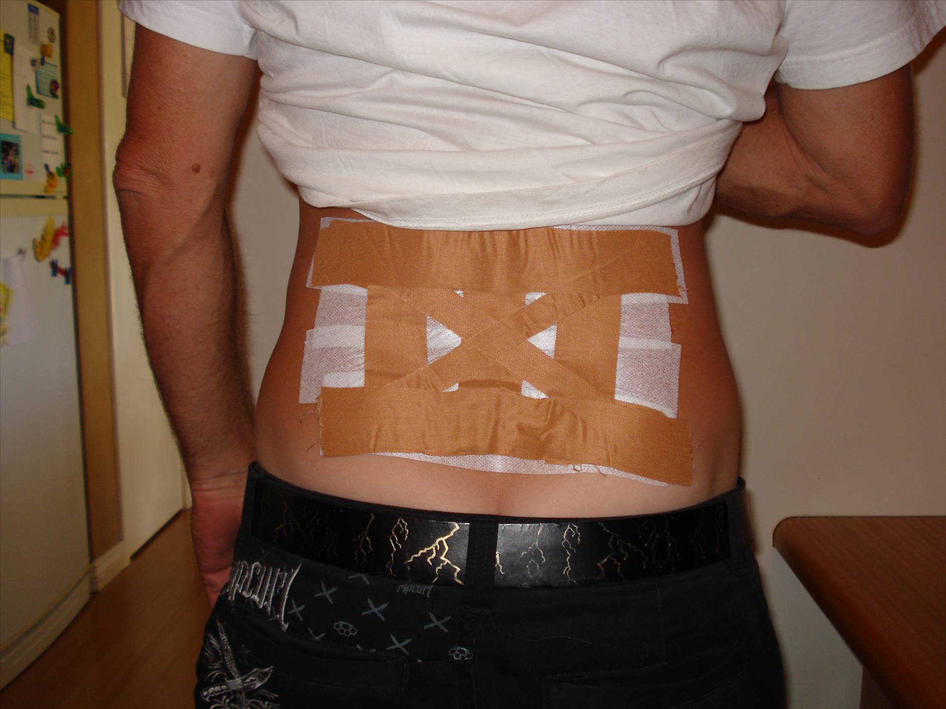 oh my back