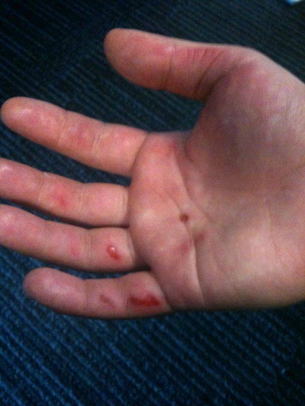 Windsurfer Hands