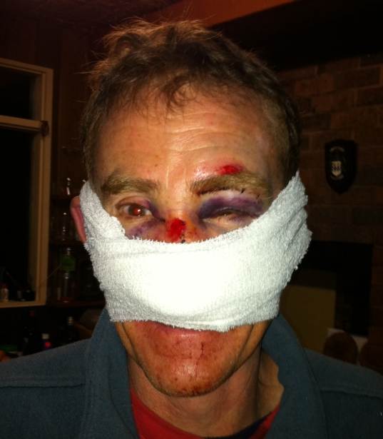 Peters Crash Face