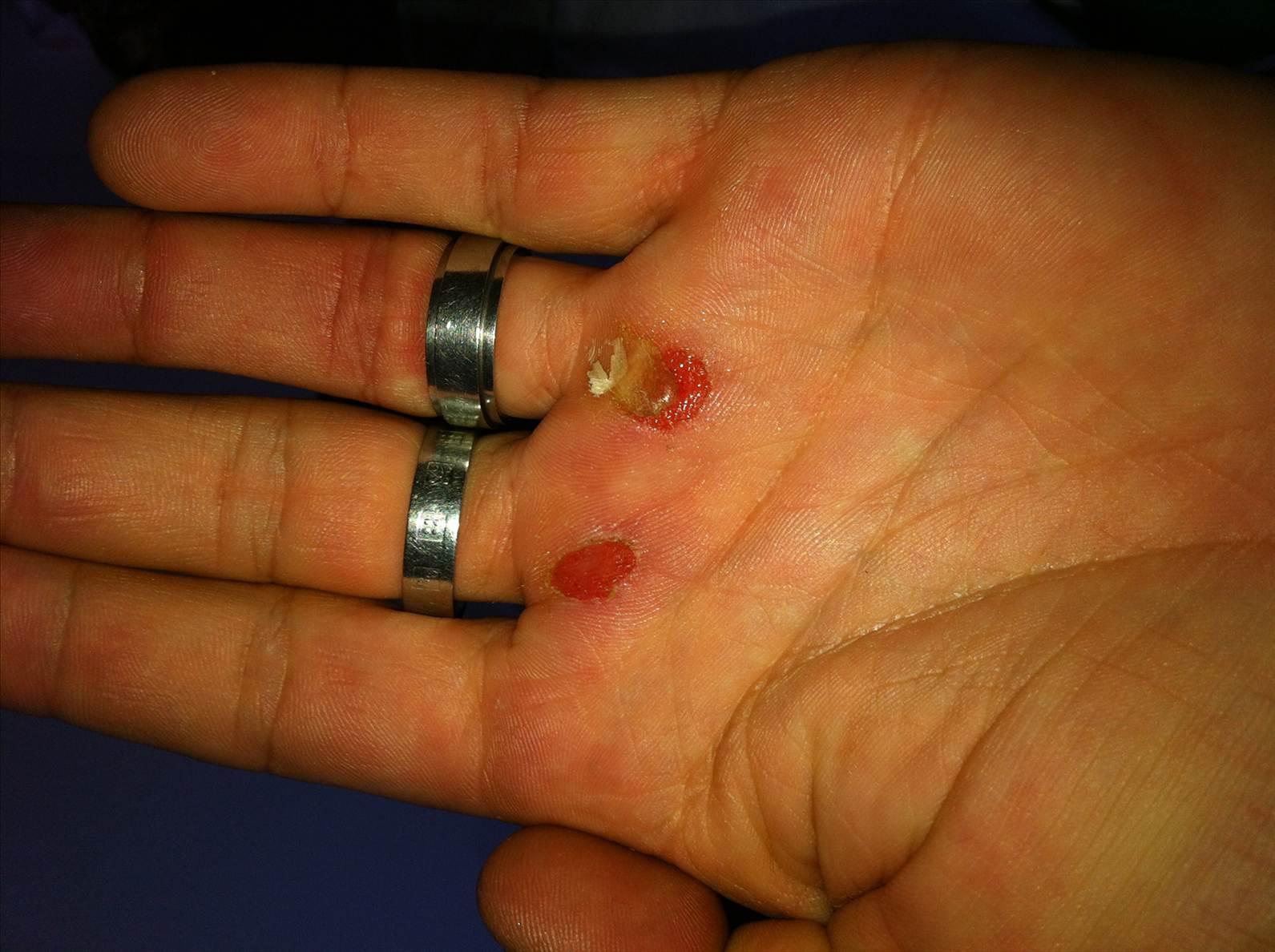 hand1