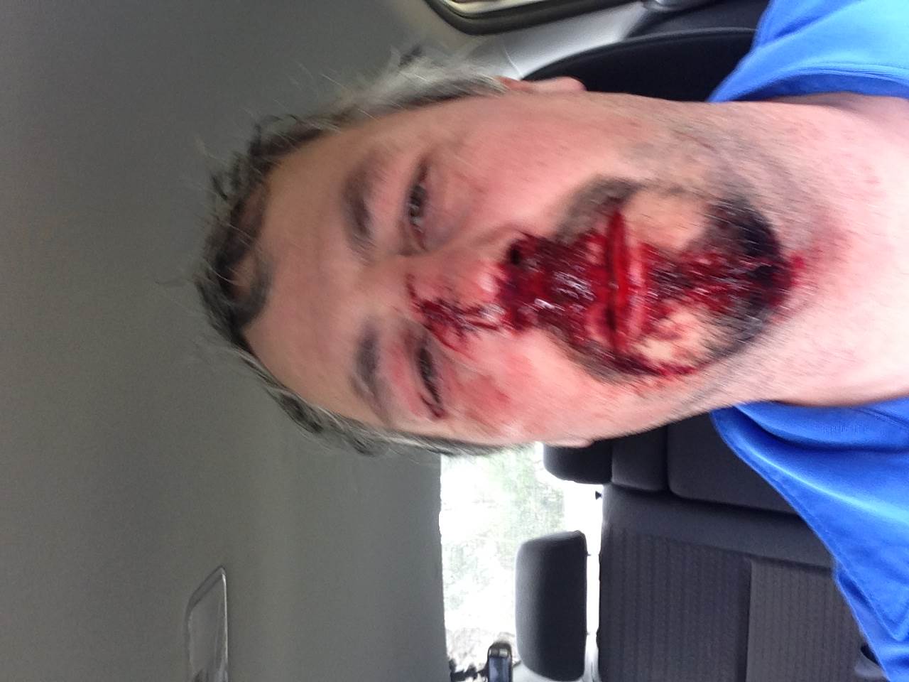 ouch!