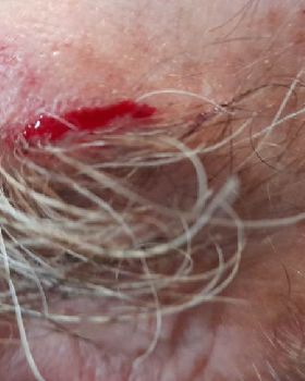 damaged Decrep